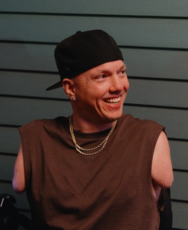 A white man with no arms wearing a backwards ball cap and gold chains smiles while looking to his left.